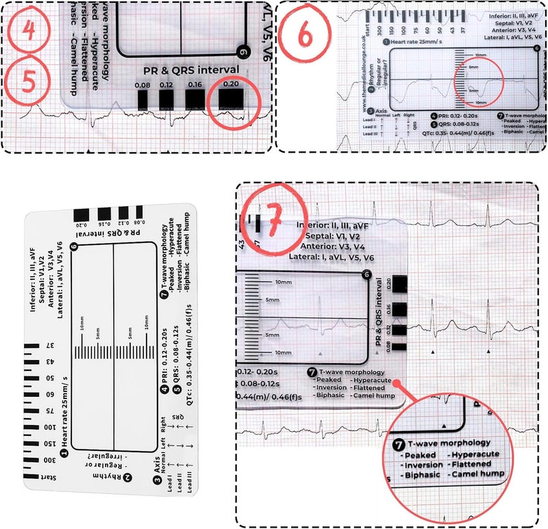 Briny River 3pcs ECG 7 Step Rulers Plastic Measuring Tool for ECG EKG Interpretation - Image 4